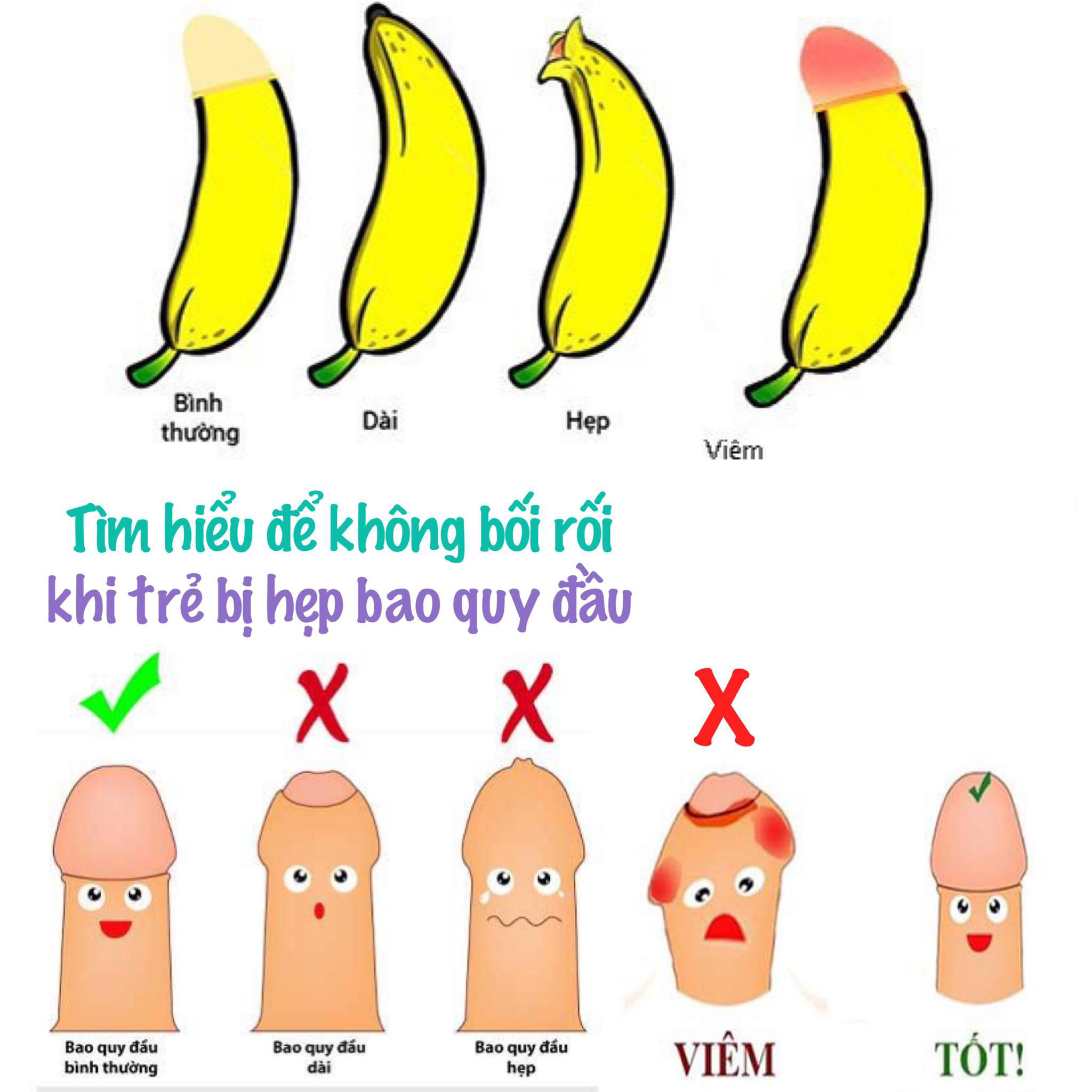 CÁCH XỬ LÝ HẸP BAO QUY ĐẦU AN TOÀN CẦN SỰ TƯ VẤN TỪ BÁC SĨ CHUYÊN KHOA