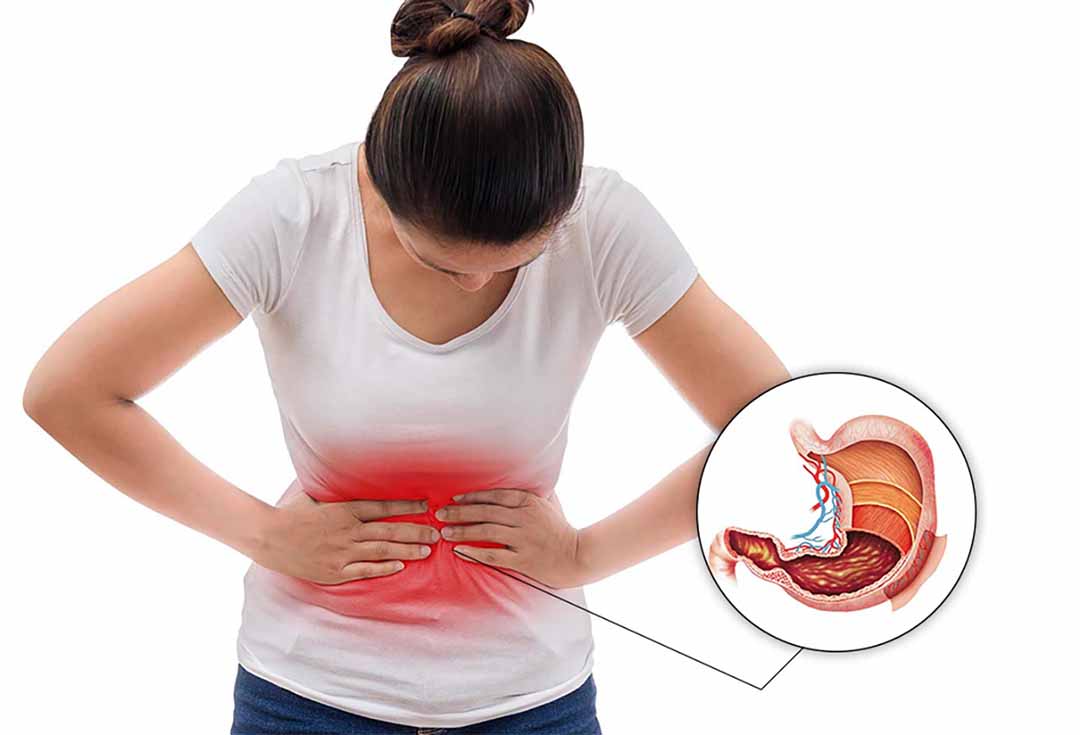 NHỮNG DẤU HIỆU ĐAU DẠ DÀY BẠN CẦN BIẾT | Bệnh viện Đa khoa Hùng Vương